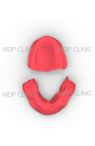 In assenza di impianti